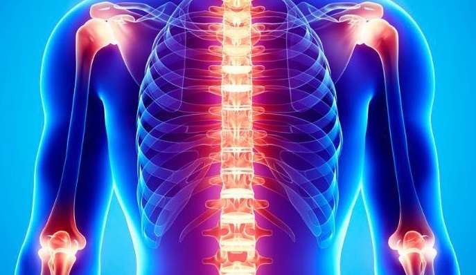 kvantiki vioanadrasi chronic-pain-mioskeletiko-systhma