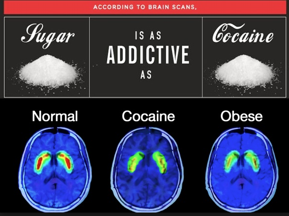 Κβαντική Βιοανάδραση Quantum Biofeedback sugar-addiction